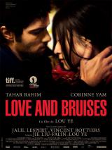 Love and bruises